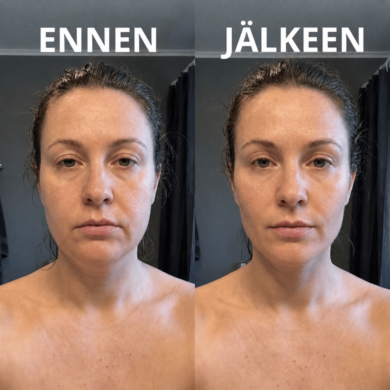 Virkumpi ja vähemmän turvonnut olo 2 minuutissa
